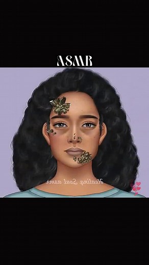 Tree Man Syndrome Treatment Explained