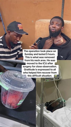 Post-Surgery Update: Recovery Journey in ICU