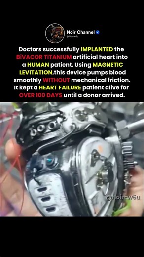 Magnetic Artificial Heart #history #facts