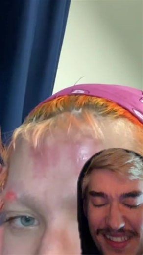 The Story Behind Hair Bleach Gone Wrong