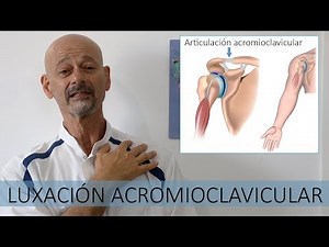 Acromioclavicular dislocation - How to treat it
