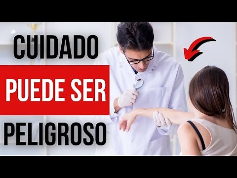 😵 Manchas Rojas en la Piel que Pican - Algunos tipos de manchas en la piel y su tratamiento