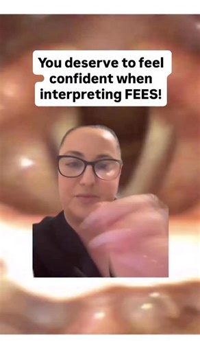 FEES competency, courses, consulting, & books for SLPs on Instagram: "✨ Anatomy Mistake Alert! ✨ When I first started FEES, I made this mistake too 😅… confusing the cuneiform cartilages with the arytenoids! Here’s the truth: we can’t actually see the arytenoid cartilages endoscopically. What we’re seeing are the corniculate tubercles sitting on top of them, and the small space between? That’s the interarytenoid space 👀. You deserve to feel confident when interpreting FEES ✅. Avoid these early 