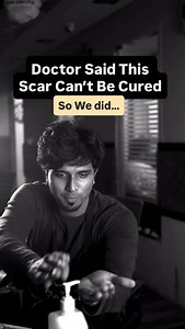 Scar coverup tattoo design ideas for men and women ! #tattooideas #scarcoveruptattoo #coverup #art | Machu Tattoo Studio