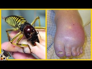 Les 10 Piqûres d'Insectes les plus Douloureuses au Monde