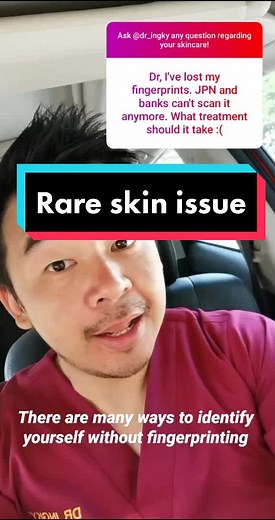 Fingerprint Troubleshooting: Causes and Solutions