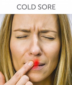 11M views · 57K reactions | 6 homemade remedies to soothe a cold.裸 bit.ly/2keKIv4 | 5-Minute Crafts | Facebook