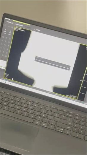 Dr system demo # x-ray 🩻