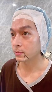 TIÊM FILLER MD CODES, TIÊM MỠ COLEMAN MẶT KỲ KỲ THAY ĐỔI RA SAO? Là một người yêu cái đẹp, luôn chủ động lựa chọn làm đẹp đúng phương pháp tại địa chỉ uy tín để giữ gìn sự tươi trẻ trên gương mặt, Kỳ Kỳ đã chọn tiêm Filler MD Codes, tiêm mỡ coleman mặt tại DIVA. - Sau tiêm Filler MD Codes gương mặt Kỳ Kỳ có những thay đổi như thế nào? - Tiêm mỡ coleman mặt giúp Kỳ Kỳ giữ gìn sự tươi trẻ ra sao? 👉 Cùng lắng nghe chia sẻ của Kỳ Kỳ qua video dưới đây nhé! ❗️Quý khách hàng đến khám vui lòng đặt lịc