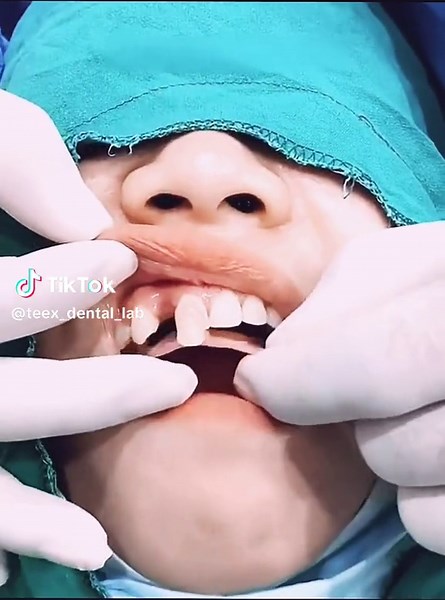 TeeX_Dental_Lab on TikTok