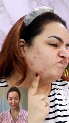 DIY celebrity Face Mask Fail| ✨ DIY Cinnamon-Honey-Lemon Face Pack!"| Kaur Pavneet