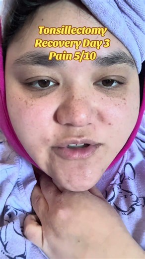Day 3 Tonsillectomy Recovery 🤕