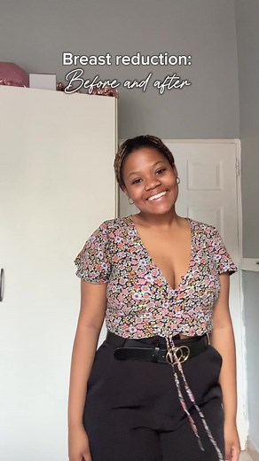 2 Months Post-Op Breast Reduction Surgery Transformation