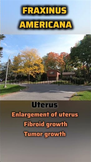 #fraxinus americana #fraxinusplant #femalemedicine #homeopathicmedicine fraxinus #uterusproblem #rgp