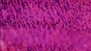 Human artery specimen. HQ video under microscope with 100x magnification. Most common cause of death in humans. Human cardiovascular system diseases. Thrombosis and cholesterol plaques. Cross section Stock Video