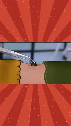 Relaxing ASMR Animation and Treatment Experience