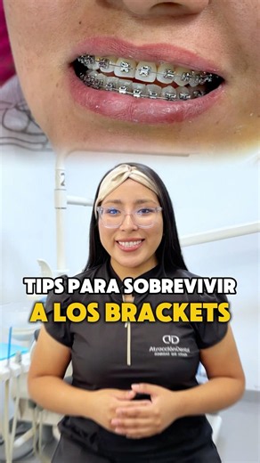 Do you have any tips for surviving braces?🧐 Let me know in the comments.☺️🦷 #braces