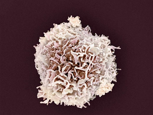 High or Low White Blood Cell Counts Can Lead to Health Problems
