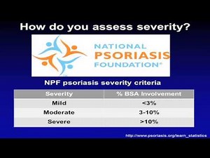 Biologics in Dermatology