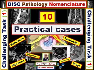10 Practical Cases (disc pathology); {Challenging Task - 1 }