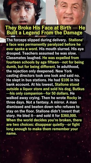 They Broke His Face at Birth — He Built a Legend From the Damage