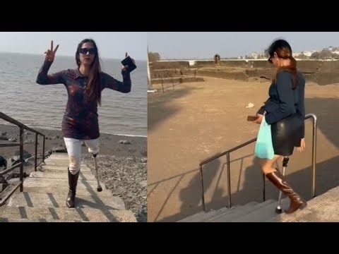 Amputee Lady Life After Amputation: Learning to Use the Stairs Again