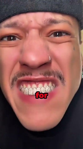 They Call Him Mr Metal Mouth