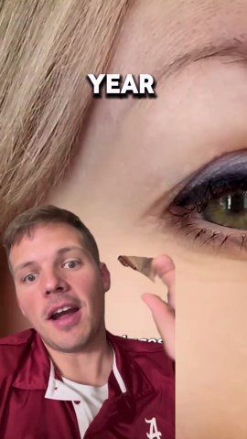 Botox $$ #botox #seo #pseo #sidehustleideas #googleads #leadgeneration #agency