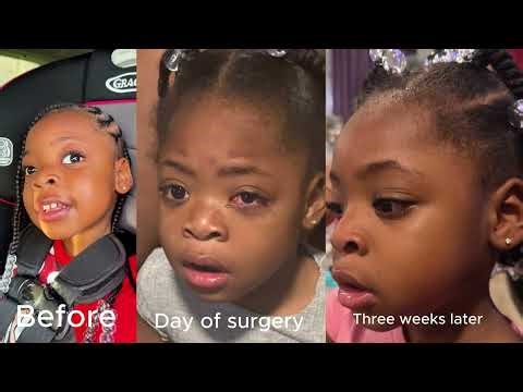 What Really Happens During Eye Surgery for Kids?