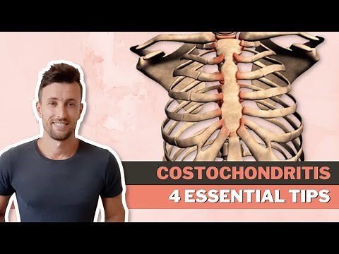 Stop Costochondritis Pain Now: Try These 4 Essential Tips