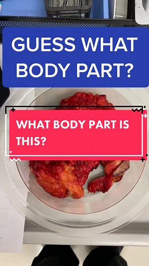 Guess #learnontiktok #plasticsurgery #brownsanatomy