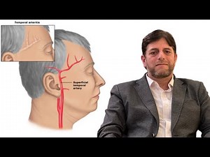 TEMPORAL Arteritis symptoms,causes and treatment by Dr Naveed awan