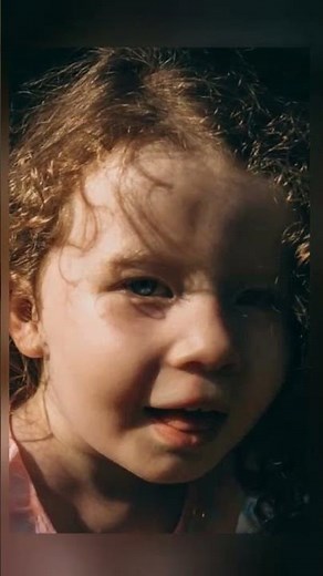 Top 10 rarest human genetic traits you won't believe exist!