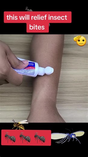 #bite #bitemechallenge #bites #ants #insect #toothpaste #relief #stress #cure #well #heal #scratch #bees #beesto_freefire🌸 #honey