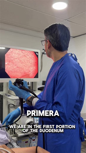 Duodenitis por Helicobacter Pylori