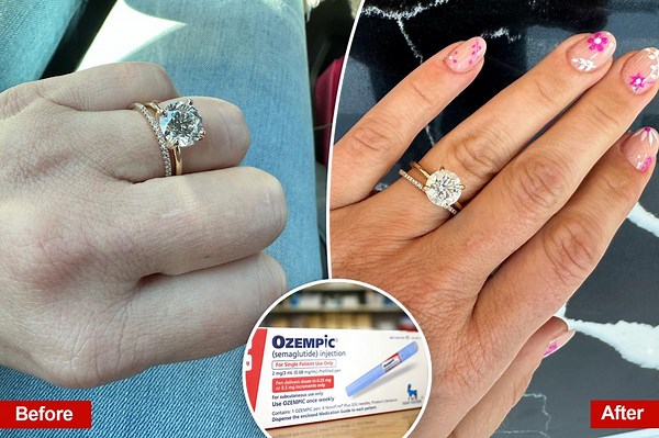 Ozempic finger is the latest side effect, and forcing women to spend more money