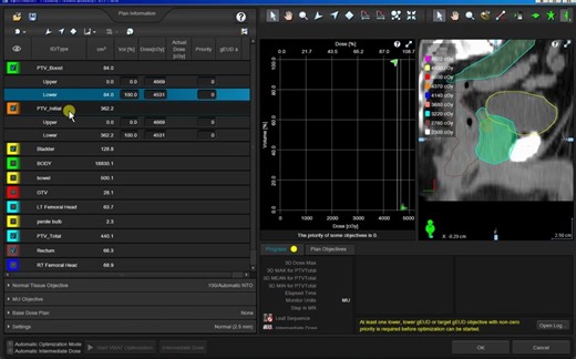 Eclipse放疗计划系统介绍