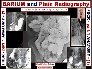 FRCR - part 1 (Anatomy) Episode-1 BARIUM and abdominal radiograph studies.
