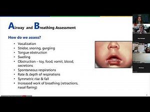 Paediatric Assessment When to Worry