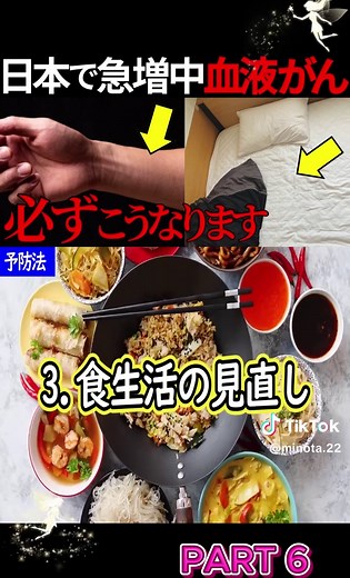 悪性リンパ腫の症状と治療法を徹底解説