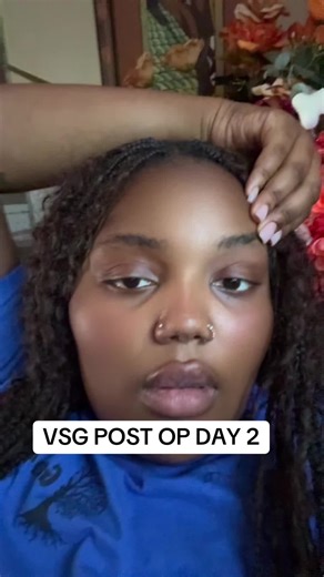 VSG Post Op Day 2: My Weight Loss Journey