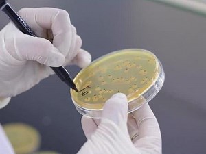 细菌计数板的计算公式