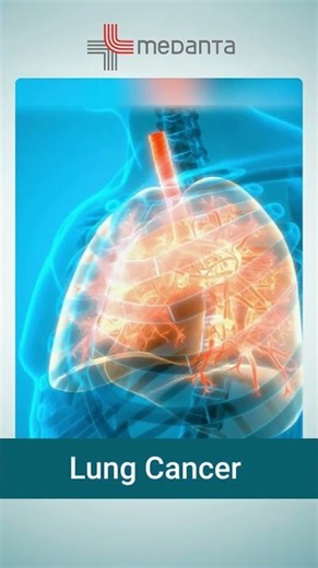 5 Most Common Types of Cancer Everyone Should Know | Dr. Mohammad Suhel | 81740 34965