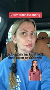 4.1K views | Before you get filler, it’s so important to let your...