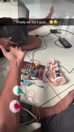 Smart prosthetic hand
