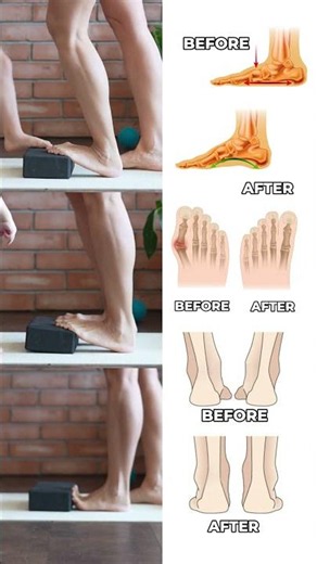 🔥 Foot Exercises with Bar: Support Valgus + Reduce Swelling 📥 SAVE THIS WORKOUT #shorts
