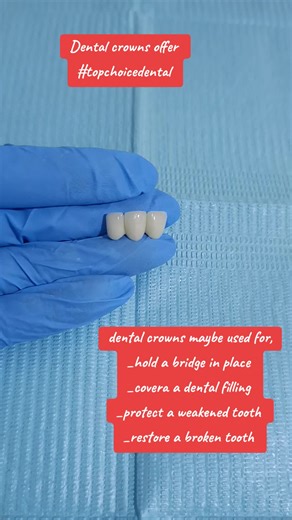 dental crowns are caps placed on the top of teeth $ they're used to restore, protect & cover your tooth call watsup 0754197265 location;0754197265