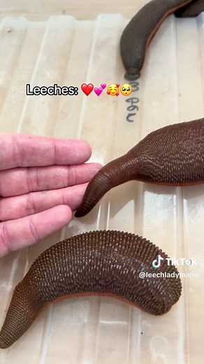 Exploring the Fascinating World of Medicinal Leeches