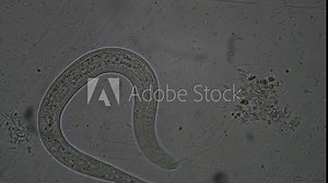 Strongyloides stercoralis larva in stool exam.Parasite in human.
