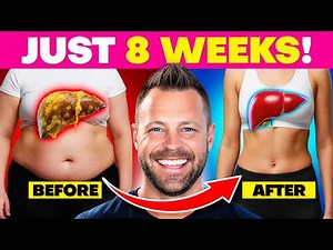 10 BEST Foods To Fix Fatty Liver And Burn Belly Fat FAST!